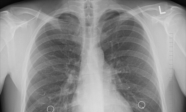 Ile kosztuje prześwietlenie stawów u psa? Ile kosztuje prześwietlenie stawów u psa?